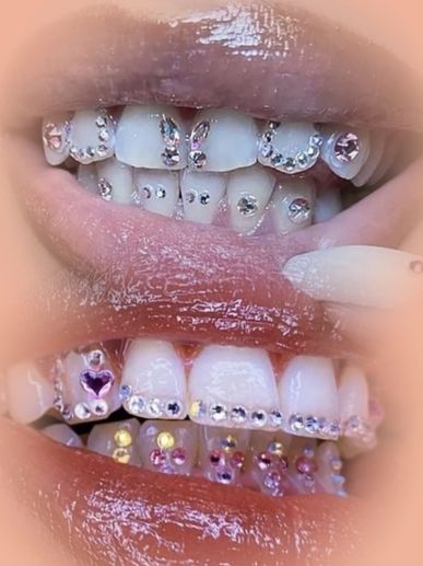 Small, sparkling Swarovski crystals are safely adhered to the surface of your tooth for a little shi