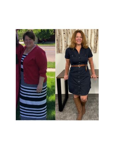 Before and after weight loss transformation of a woman.