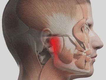 pain originating from face. facial pain referred to in the tooth