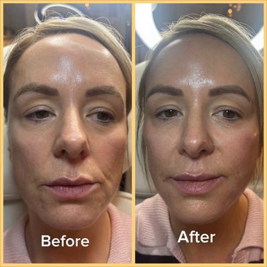 Natural filler Newtownards