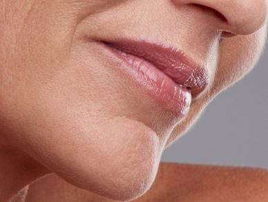 Lip filler natural