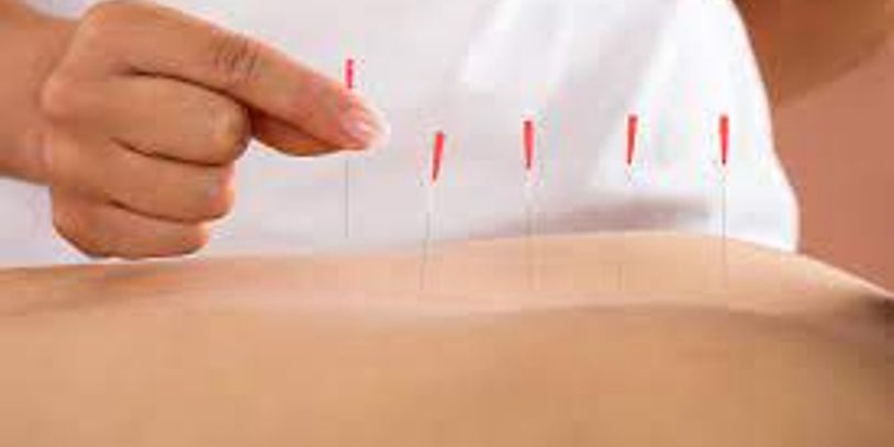 Cold Laser Therapy & Trigger Point Dry Needling