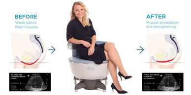 Lady sitting on the BTL Emsella chair