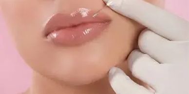 lips being injected with lip filler 