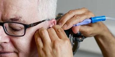 man having ear wax removal by micro-suction or irrigation