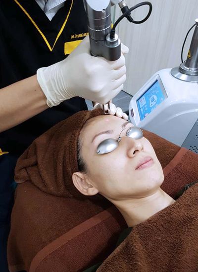 model having co2 laser treatment