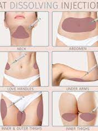 pictures showing areas where fat dissolving injections can be used