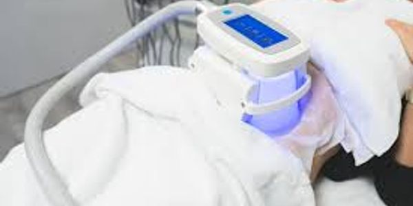 cryolipolysis being undertaken on someone's abdomen to reduce the fat and body shaping process