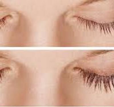 before and after eyelash enhancement treatment