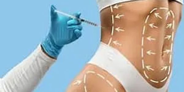 fat dissolving injections being administered into body area