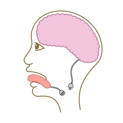 Illustration of a brain and tongue with electrical plugs inside a human head outline.