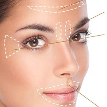 Botox Manteca CA Dr. Abbas Kashani