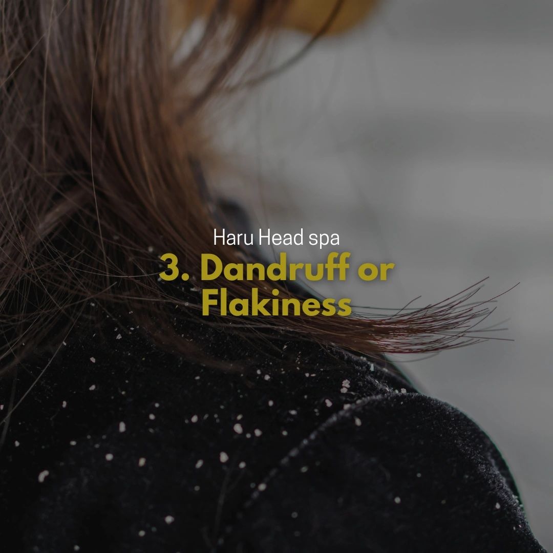 Close-up of a person's hair showing dandruff or flakiness on the shoulders, with text overlay about a head spa service.