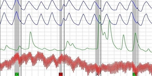 Polygraph chart