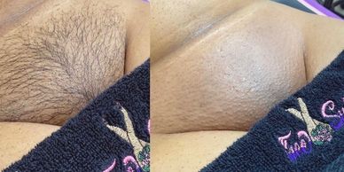 Before and after of our Famous Brazilian Wax. First time $50