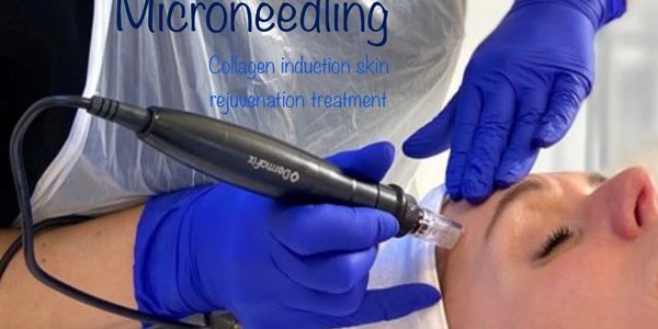 Acne scarring facial cold plasma micro needling anti ageing 
