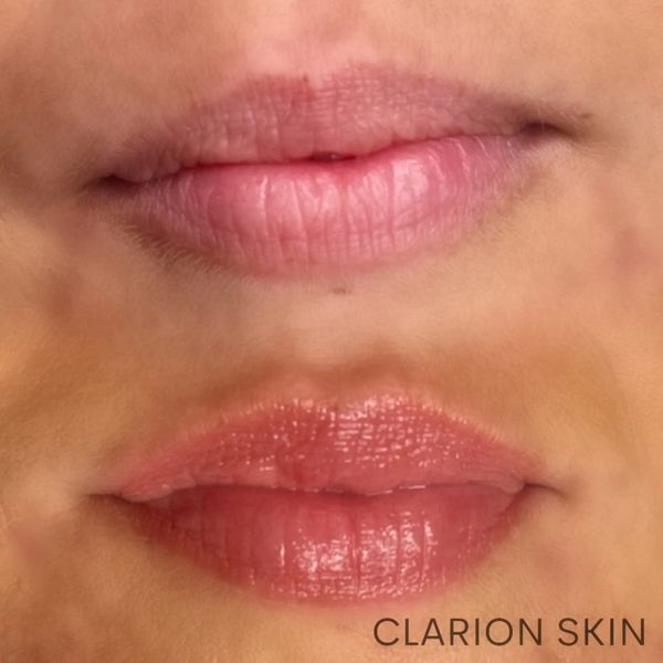 Lips before and after lip blush tattoo
