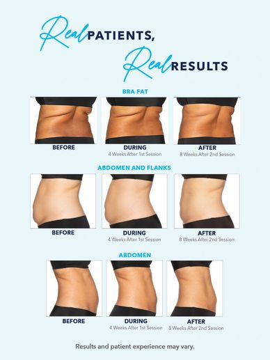 COOLSCULPTING PROMO