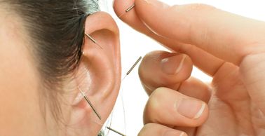 Auricular acupuncture is beneficial for pain, stress, anxiety, addition, smoking cessation, and more