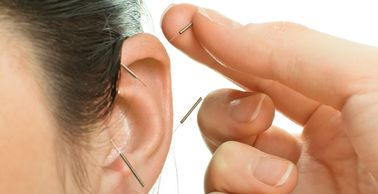 Auricular acupuncture is beneficial for pain, stress, anxiety, addition, smoking cessation, and more