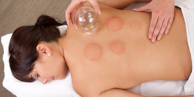 Cupping Therapy is used in Chinese Medicine to alleviate pain, inflammation, and muscular tension.