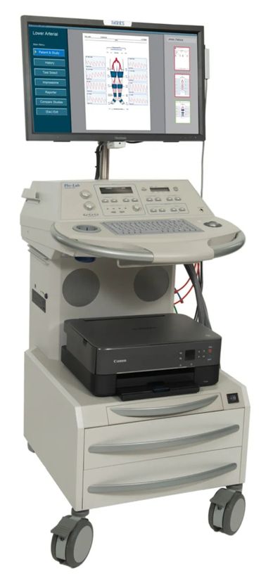 Medical diagnostic machine with monitor and printer on a wheeled cart.