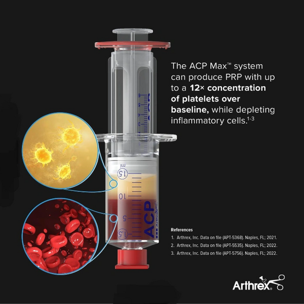 A syringe of platelets and blood to utilize in cellular repair by arthrex