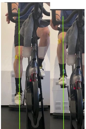 Peloton Bike Fitting for Knee Pain Mitigation
