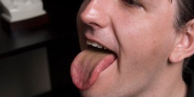 Chinese medicine tongue diagnosis - British Acupuncture Council.