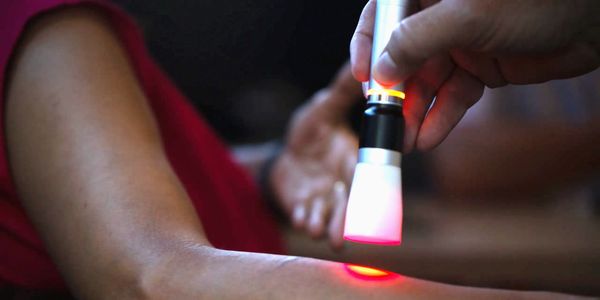 Chiropractor performing laser therapy on a patient’s arm to reduce inflammation and relieve pain
