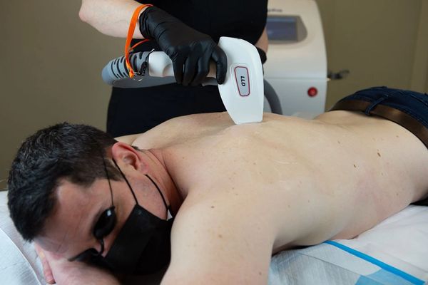 Laser Hair Removal Back