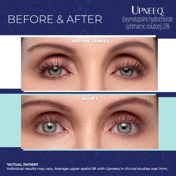 eye treatment