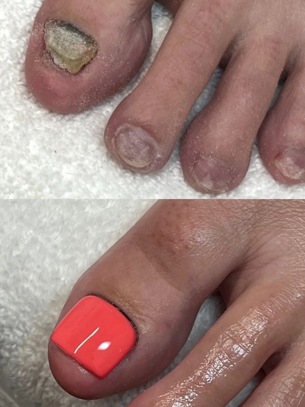 Before and after images of a toenail restoration with bright coral nail polish.