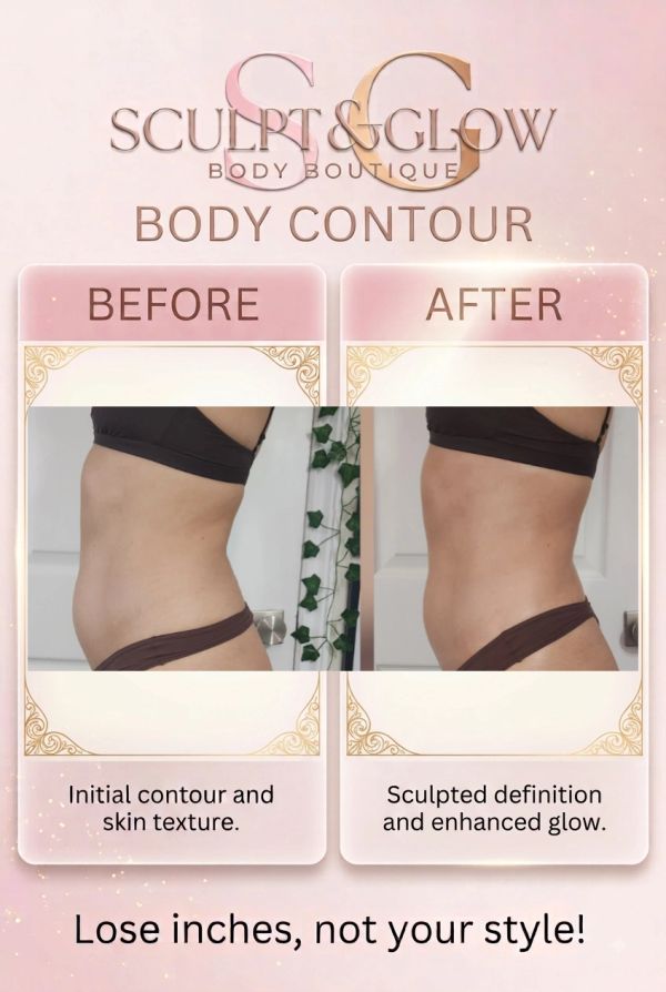 Before and after body contour results showing slimmer waist and improved skin texture.