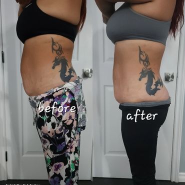 WAIST SLIMMING & SCULPTING PACAKGE 
