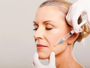 Sculptra treatment stimulates collagen production by injecting poly-L-lactic acid into the skin