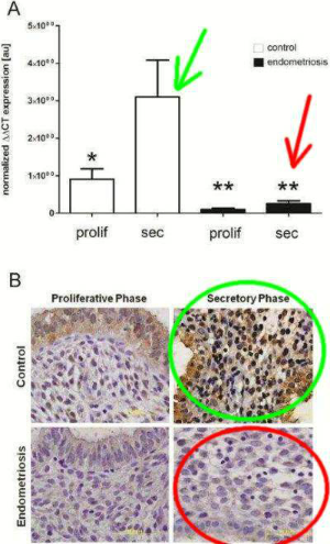 Progesterone-dependent Regulation of Endometrial Cannabinoid Receptor