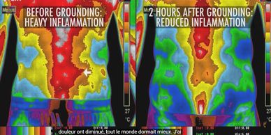 Before grounding heavy inflammation and after grounding reduced inflammation, image of a 