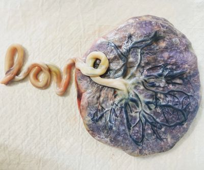 Placenta with umbilical cord shaped into the word 'love'.