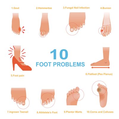 common foot problems