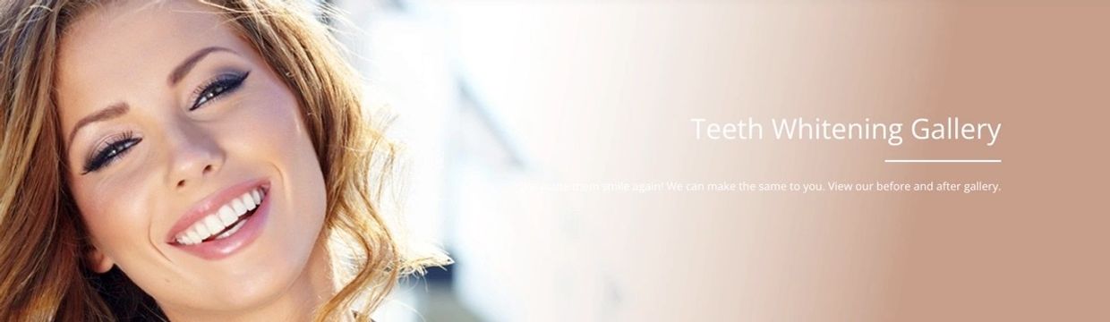 Teeth whitening