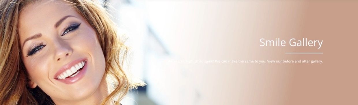 Smile Gallery
