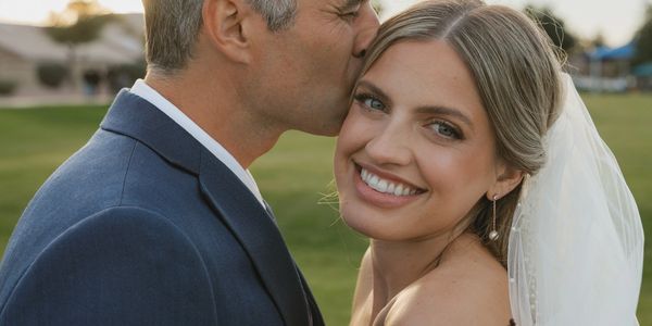 Groom kisses bride on the forehead, both smiling happily outdoors.
