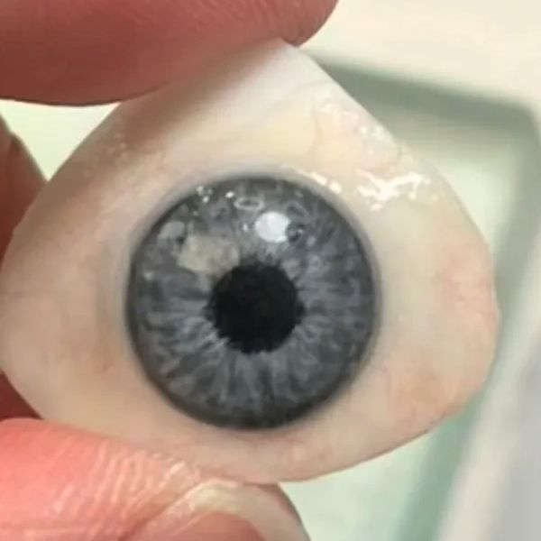 Artificial eyes uk