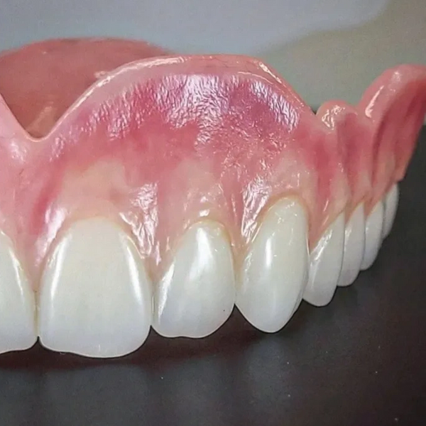 Upper acrylic denture