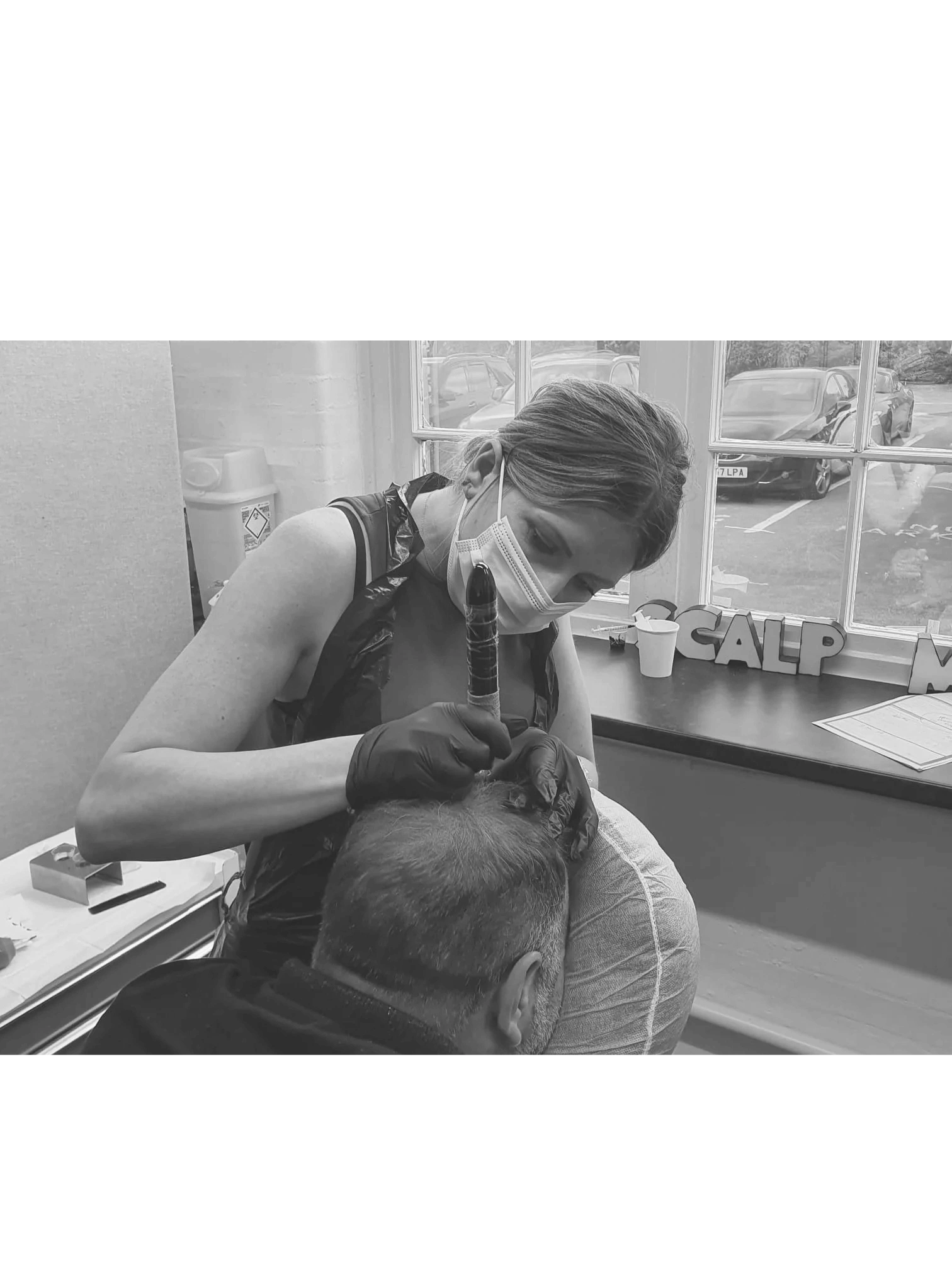 Scalp Micropigmentation | SMP | Surrey Scalp Clinic