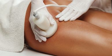 A person receiving a cellulite treatment on their thigh with a handheld device.