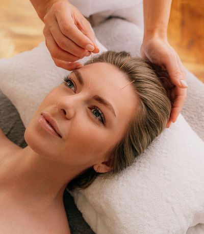 Kasvoakupunktio, akupunktio, korva-akupunktio, kosmeettinen akupunktio