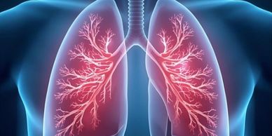 An image of the lungs