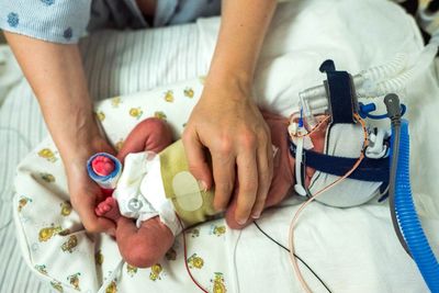 Premature baby in NICU with medical support and parent's hands providing care.